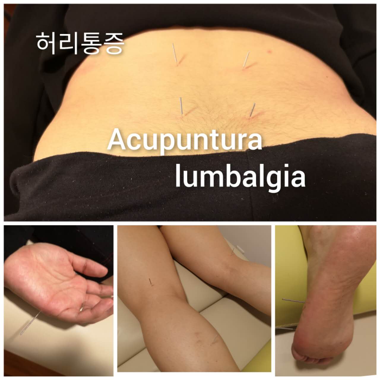 腰痛.jpg