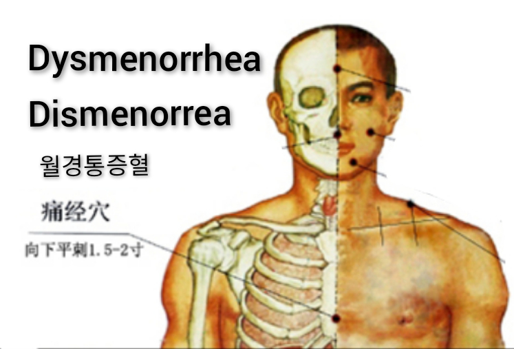 痛经.jpg