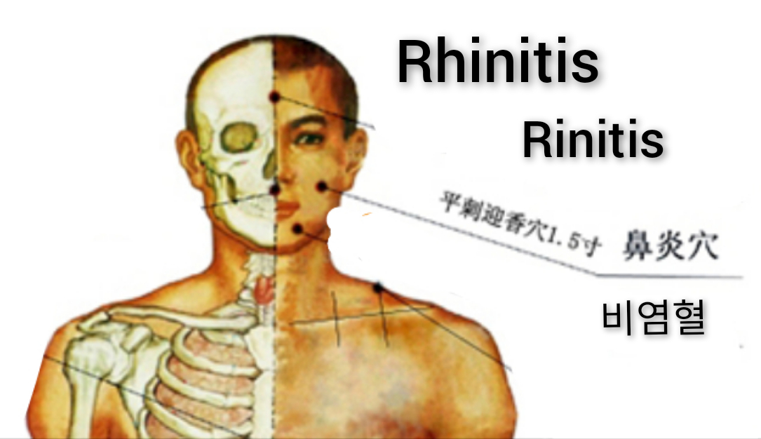鼻炎.jpg