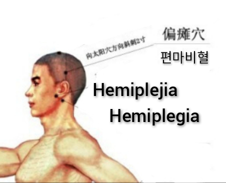 遍瘫.jpg