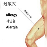 过敏.png