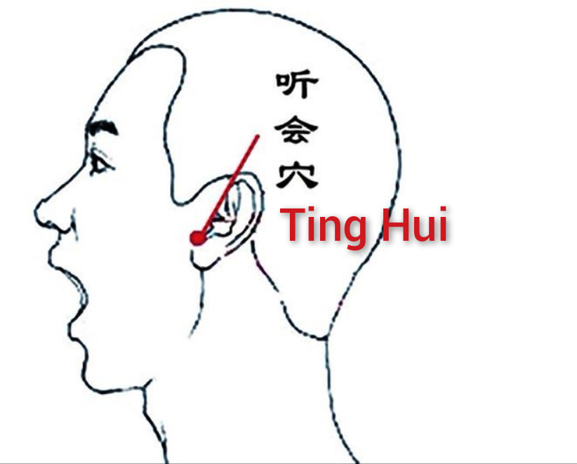 听会.jpg