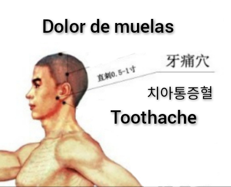 牙痛.jpg