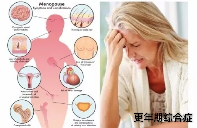 更年期综合征1.jpg