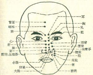 鼻针图.png