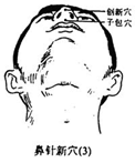 鼻针新穴.png