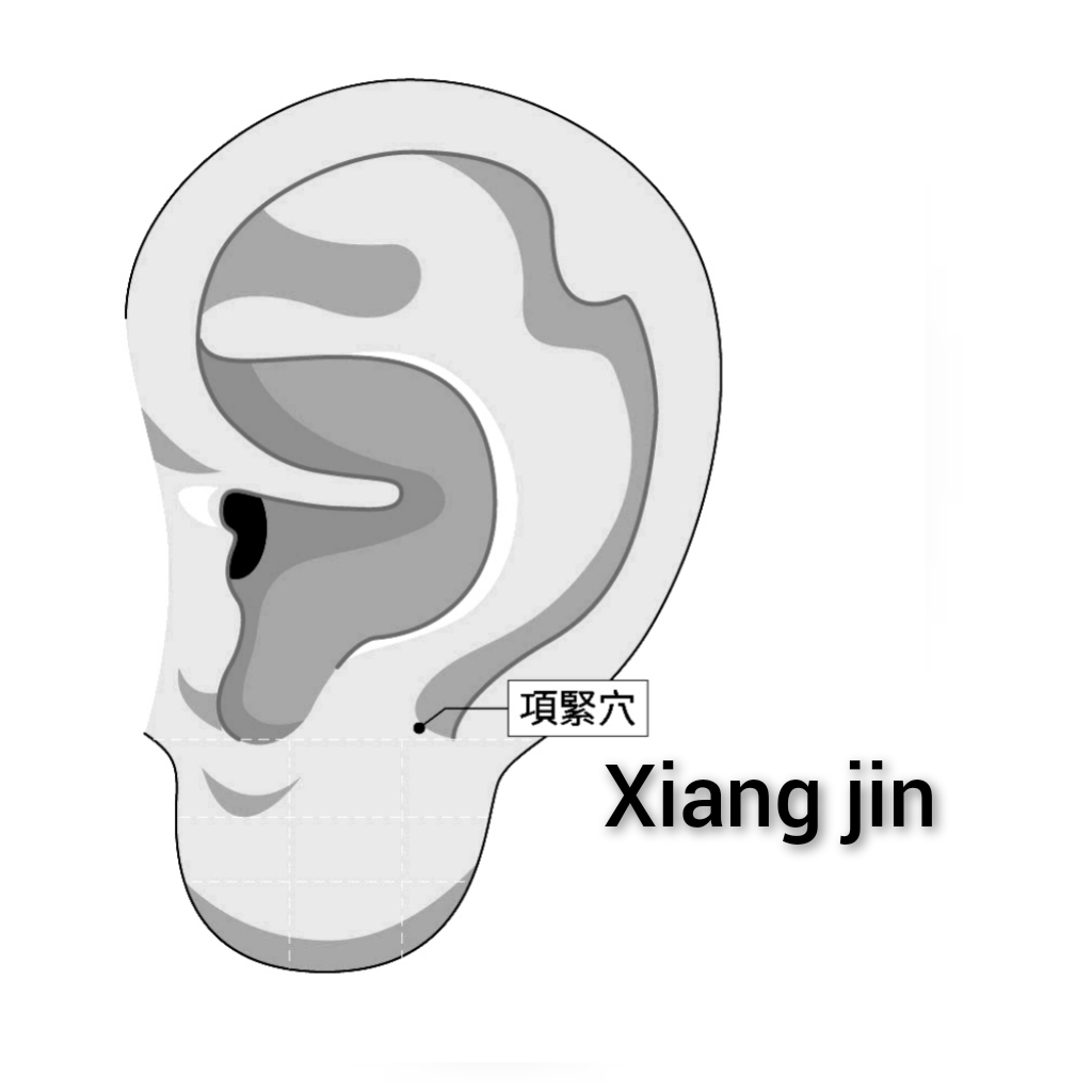 项紧.jpg