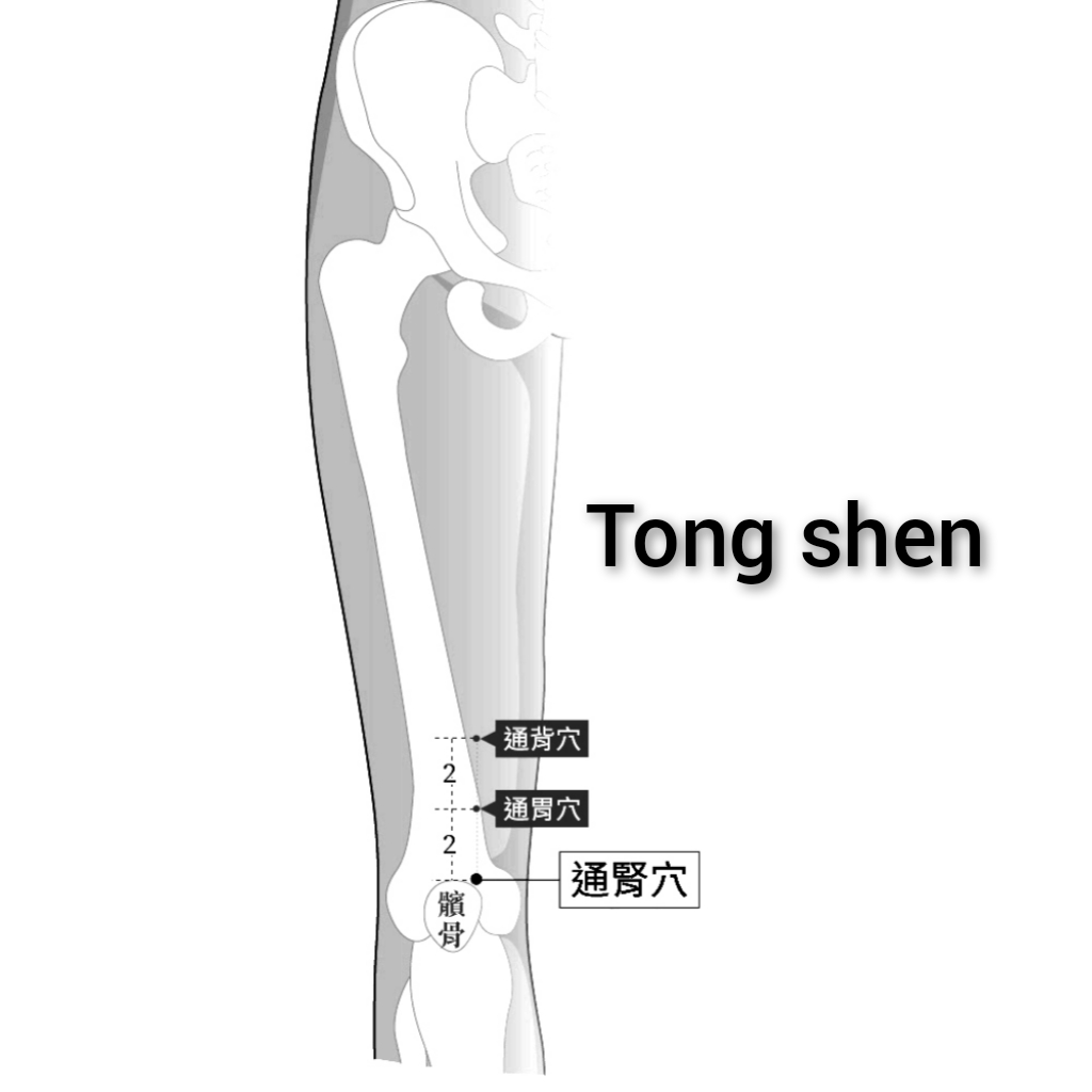 通肾.jpg