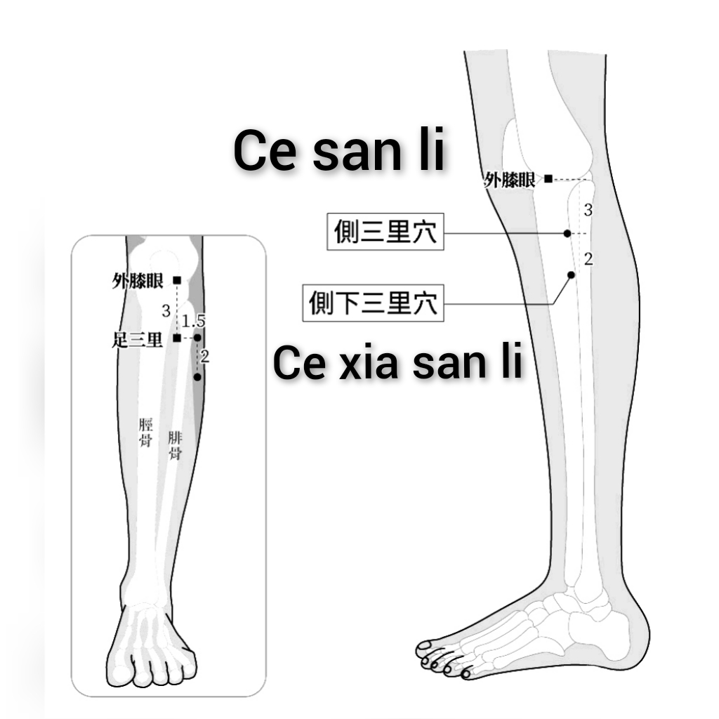侧三侧下.jpg