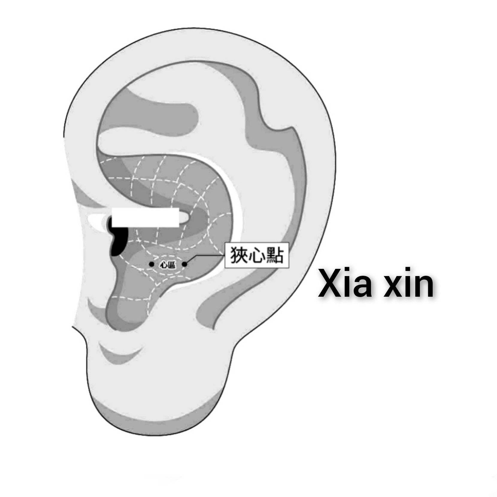 狭心.jpg