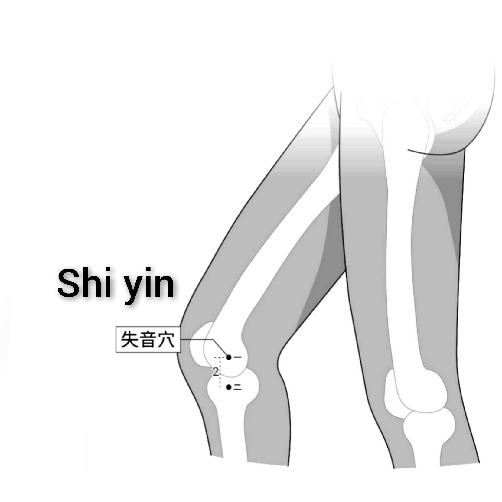 失音.jpg