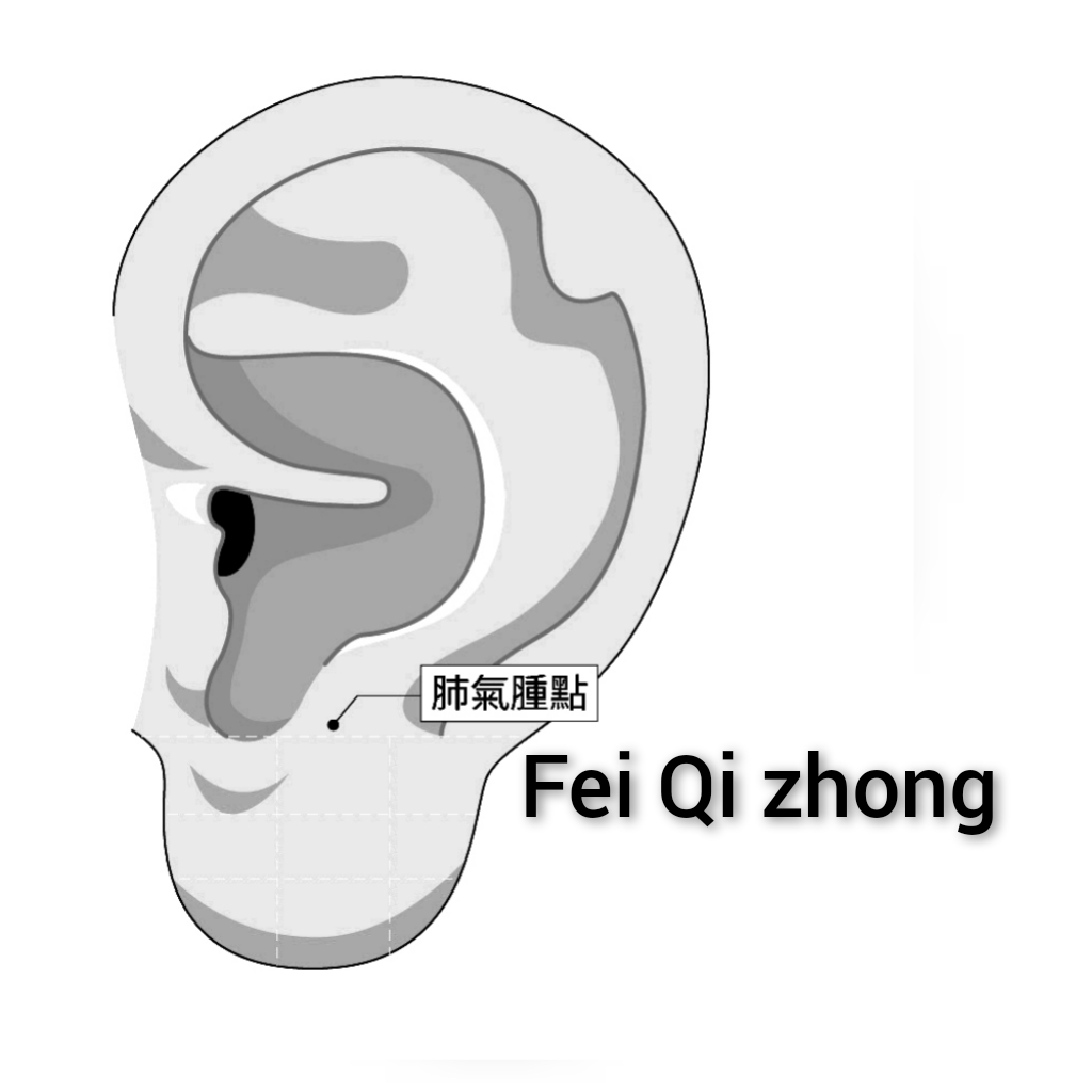 肺气肿.jpg