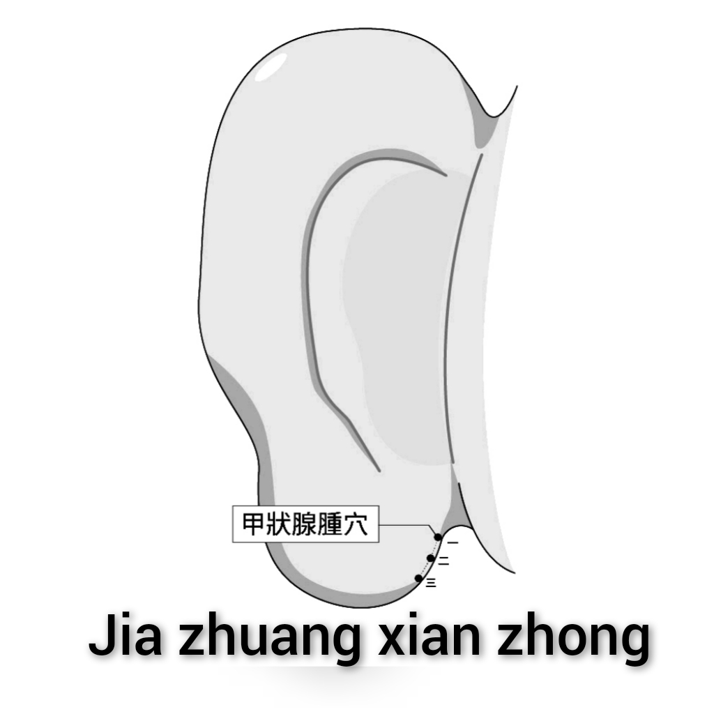 甲状腺肿.jpg