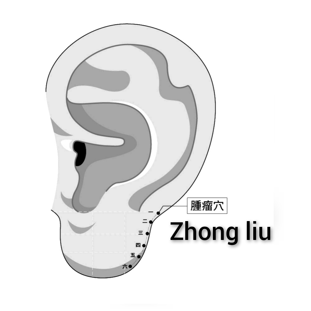 肿瘤.jpg
