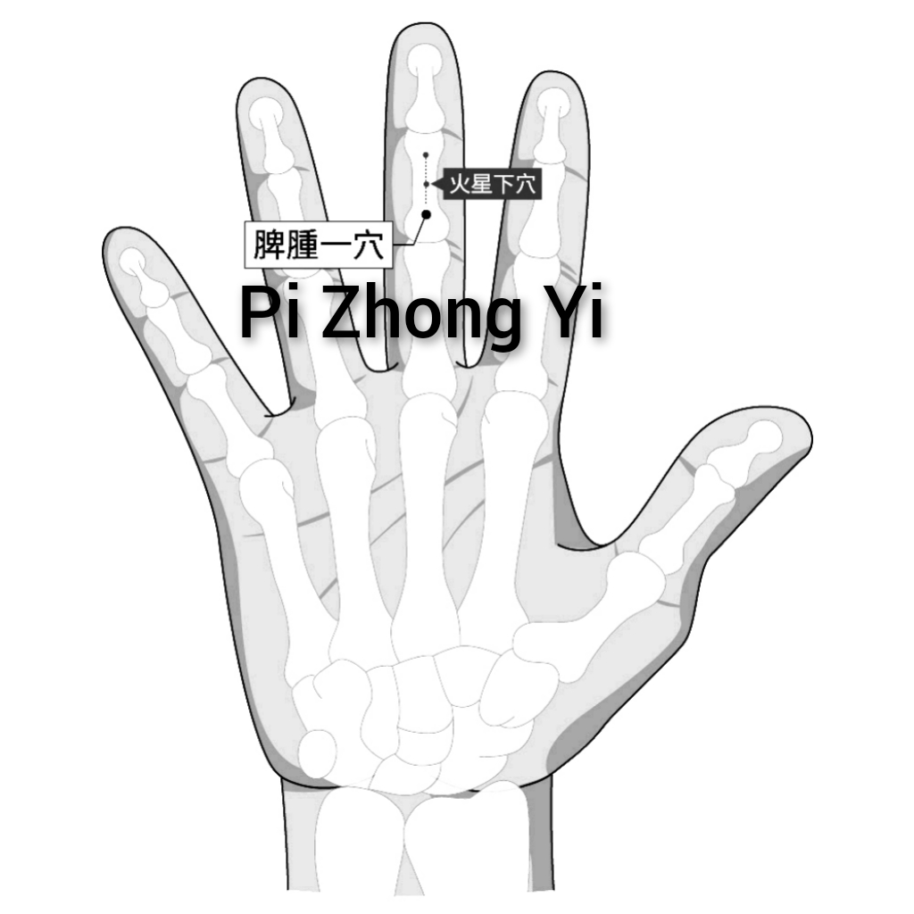 脾腫一.jpg