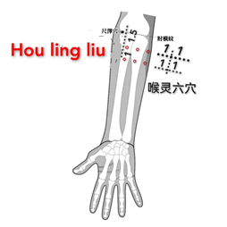 喉灵六.png