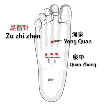 足智针.jpg