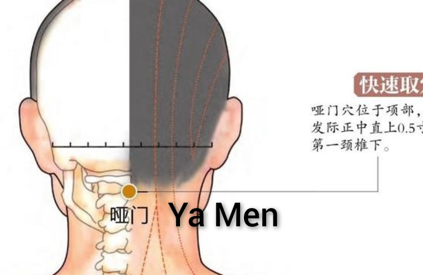 亚门1.jpg