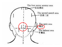 头穴-视区.png