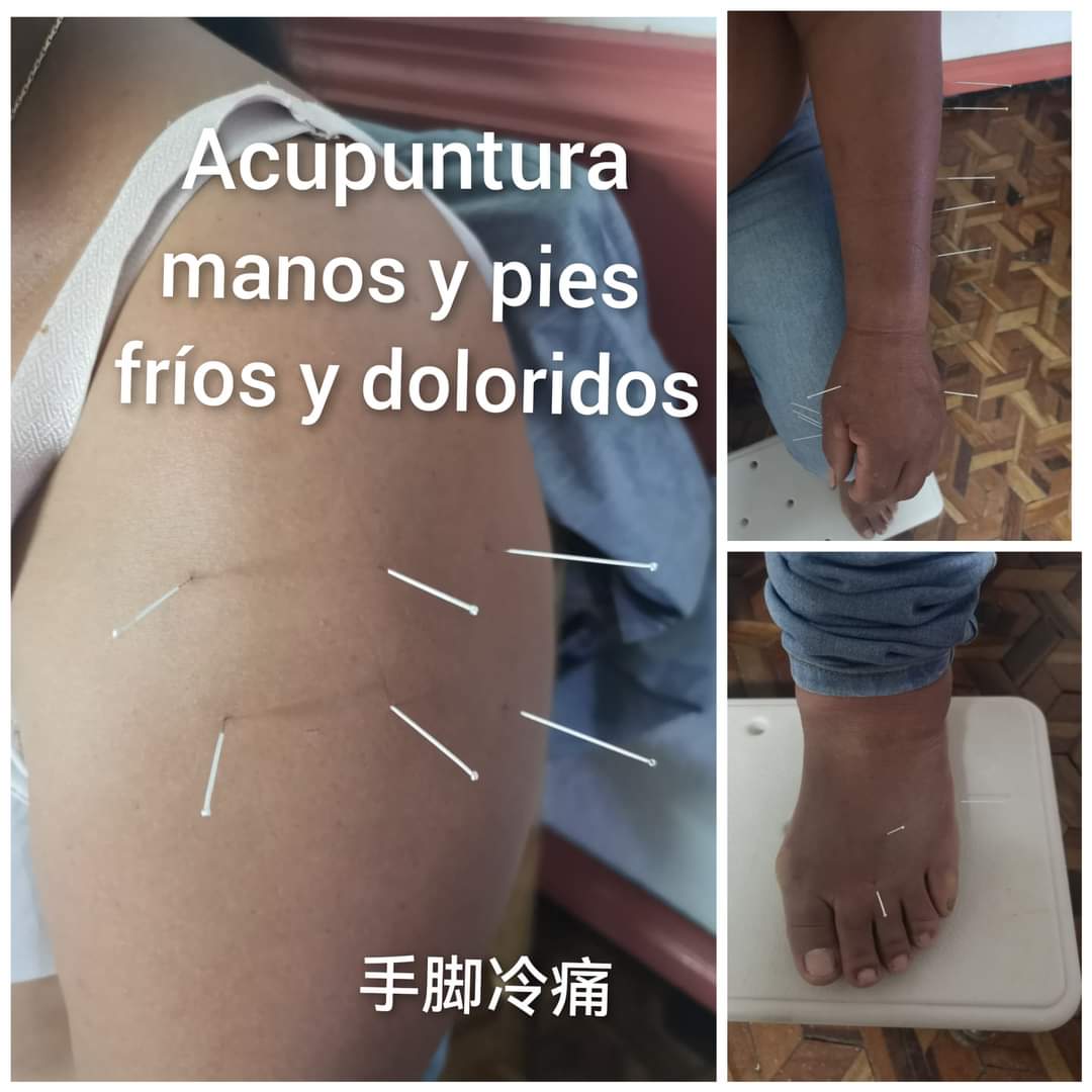 手脚冷痛.jpg