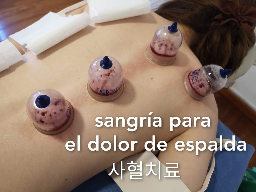 刺血治疗.jpg