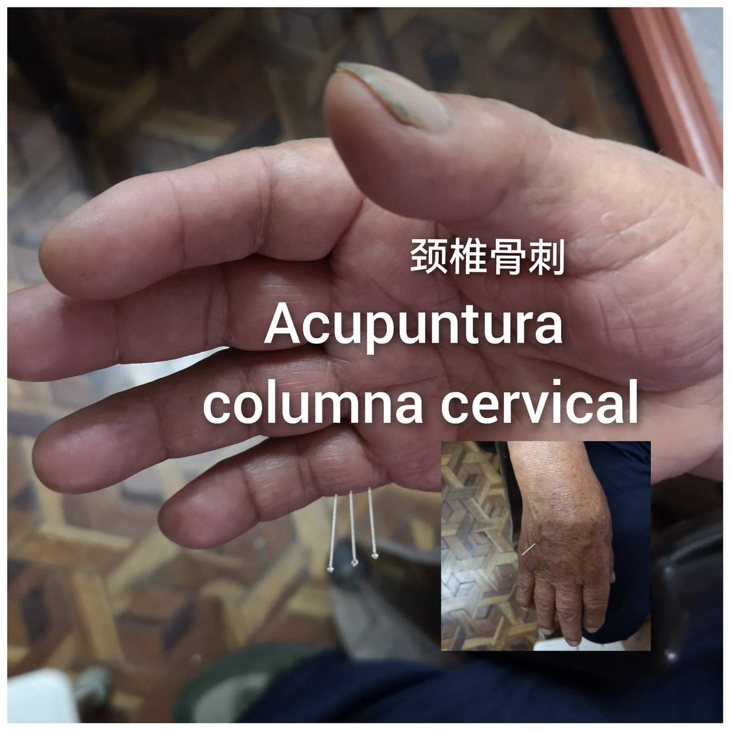 颈椎刺骨.jpg