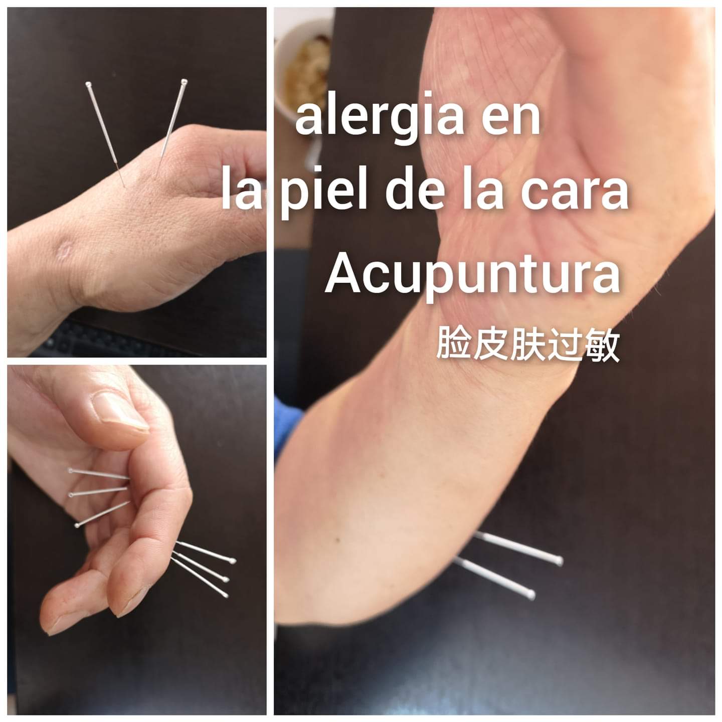 脸皮肤过敏.jpg