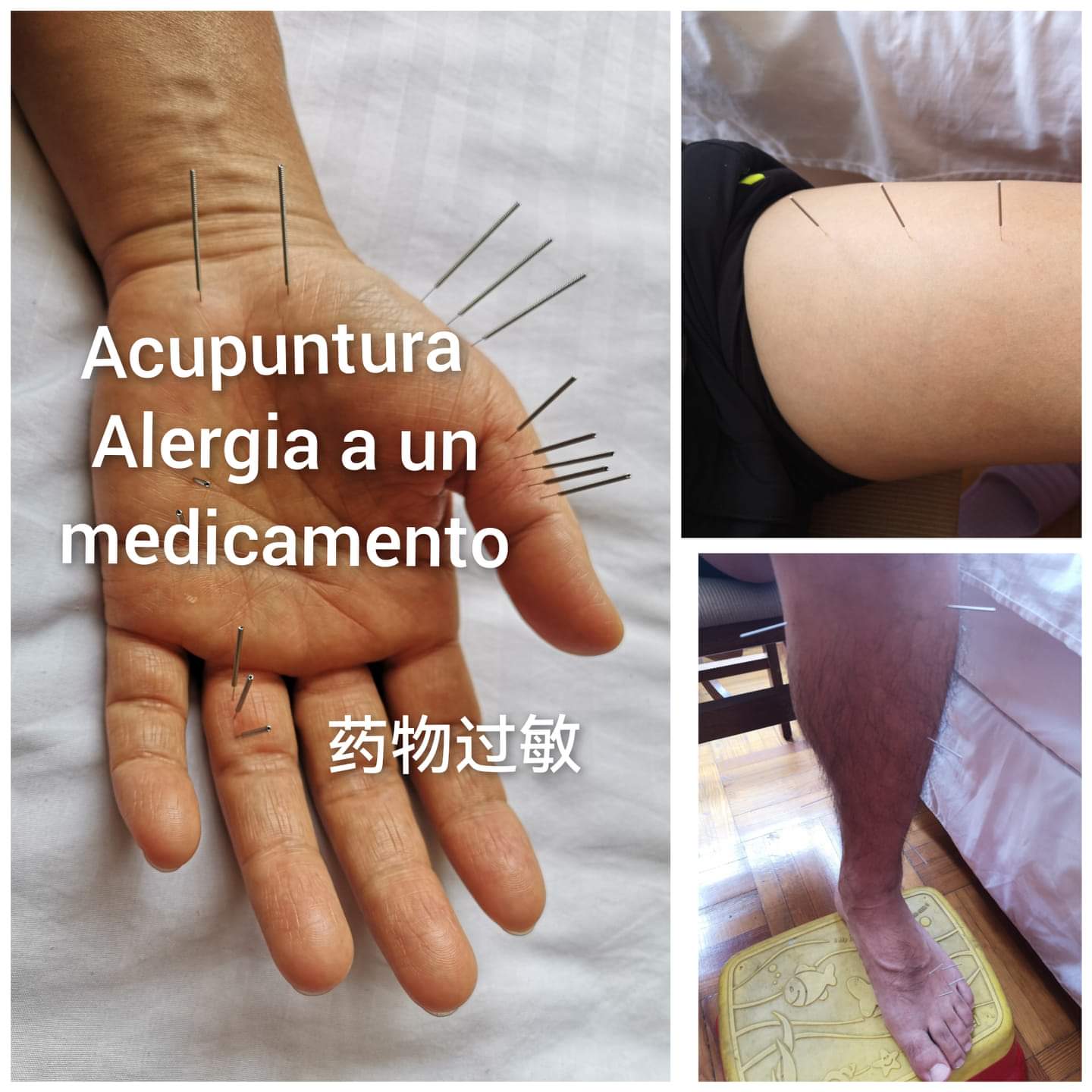 药物过敏.jpg