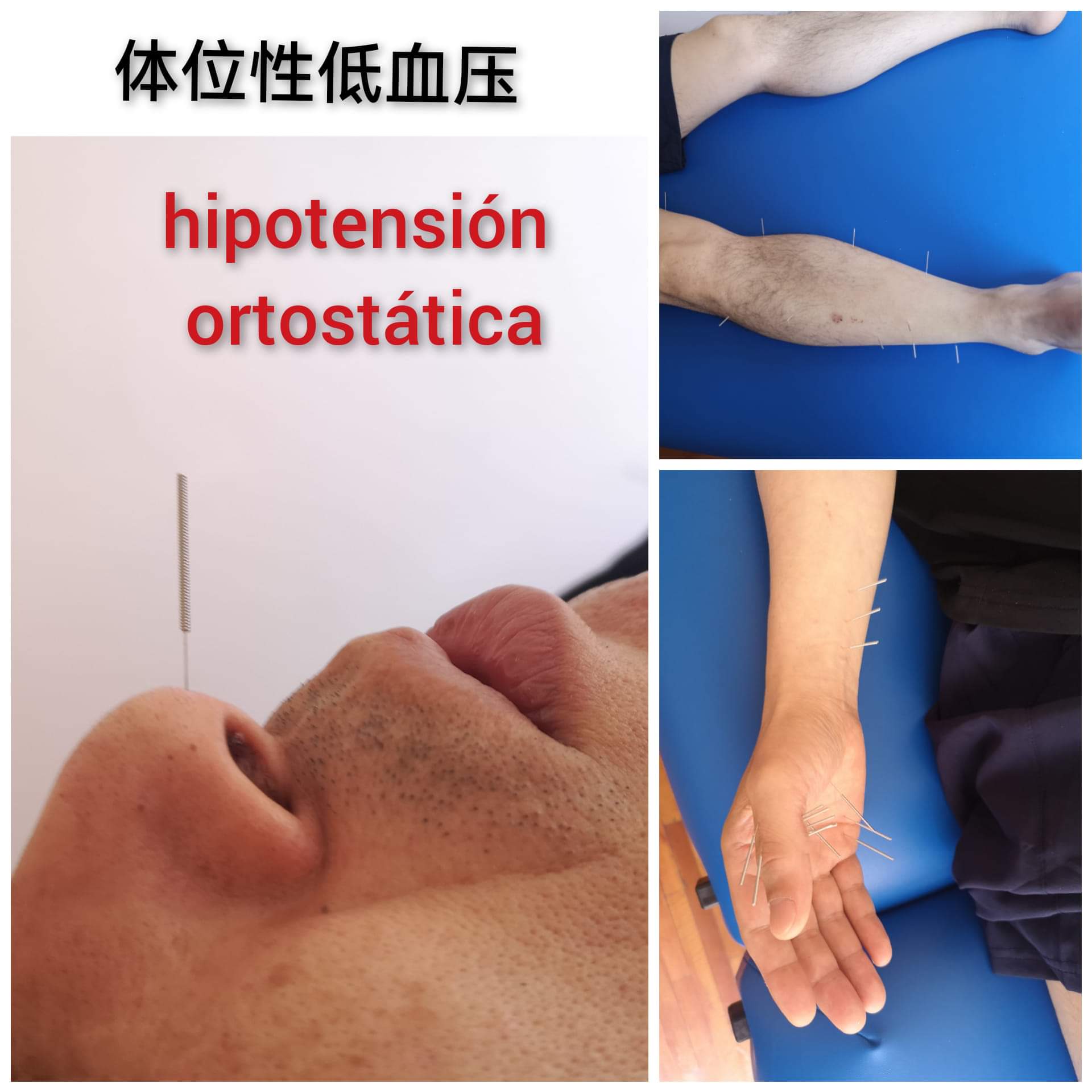 体位型低血压.jpg
