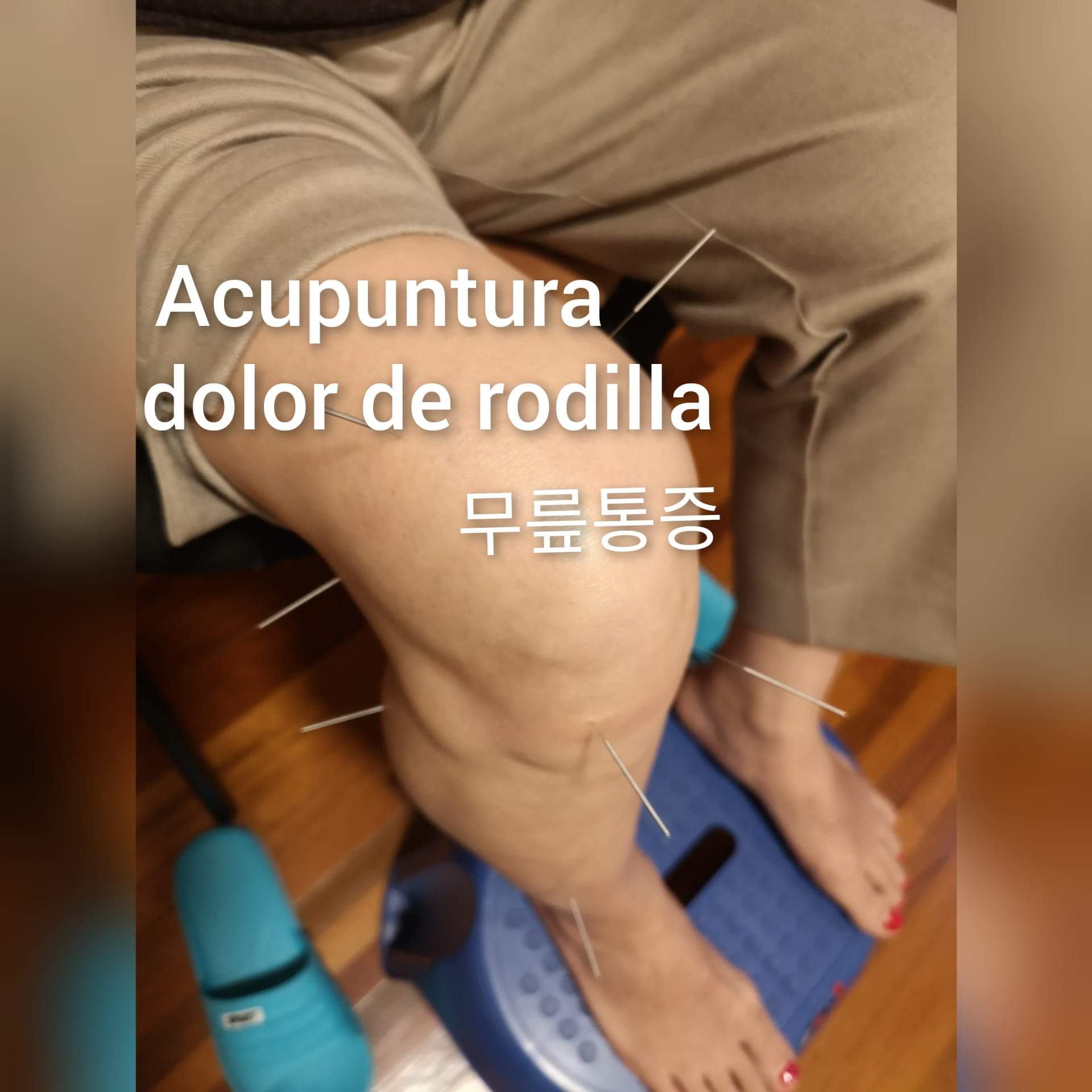 膝盖疼.jpg