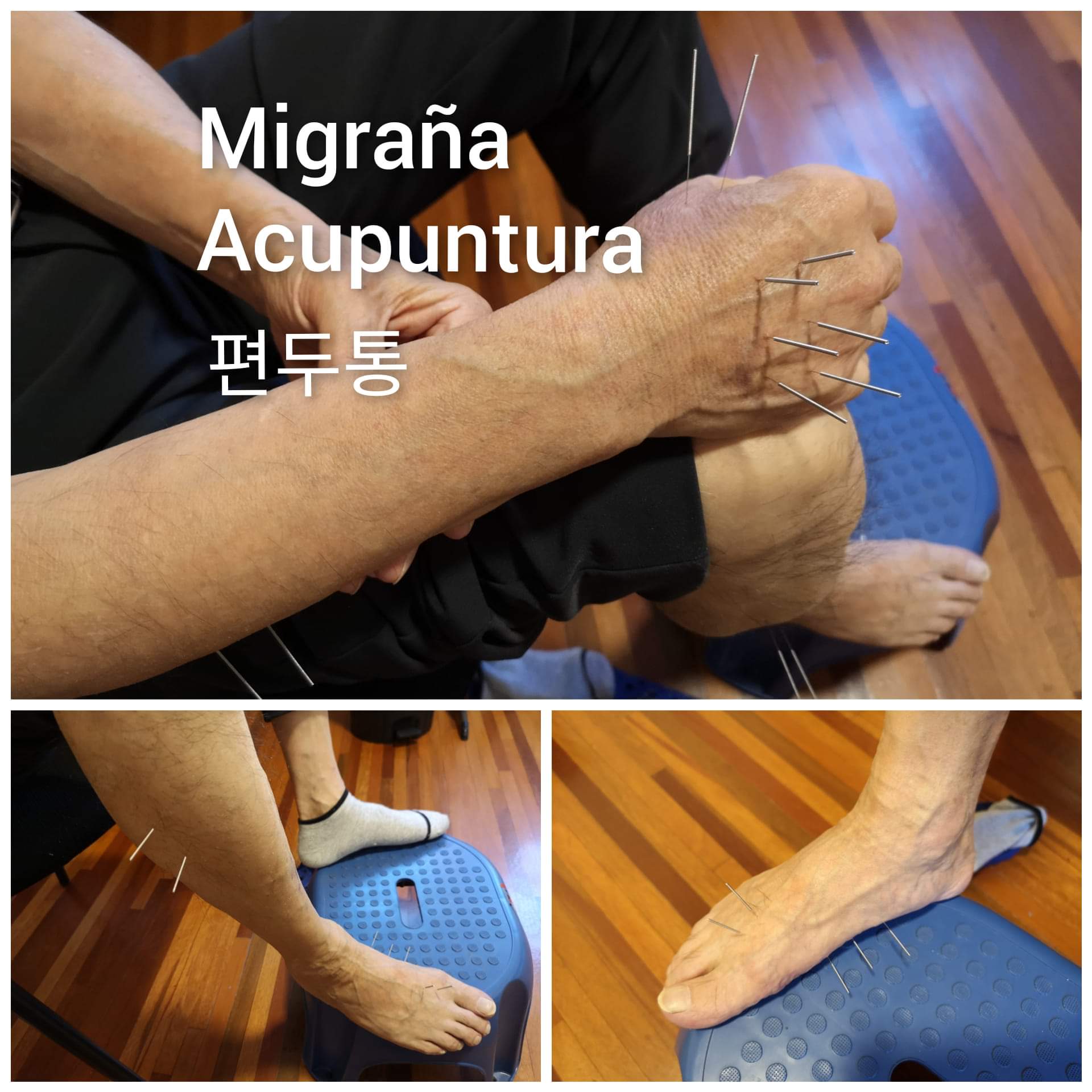 偏头痛3.jpg