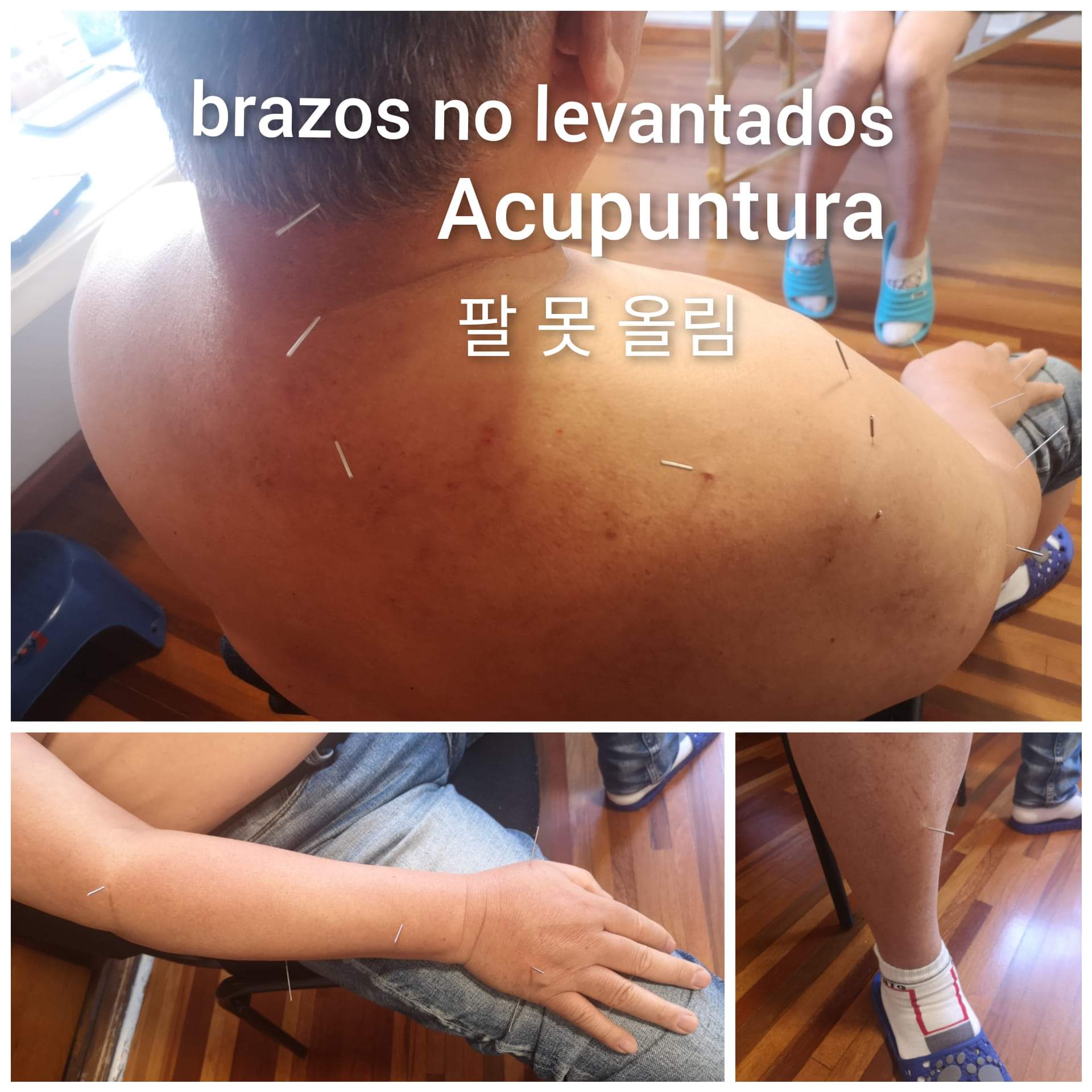 胳膊不能抬高.jpg