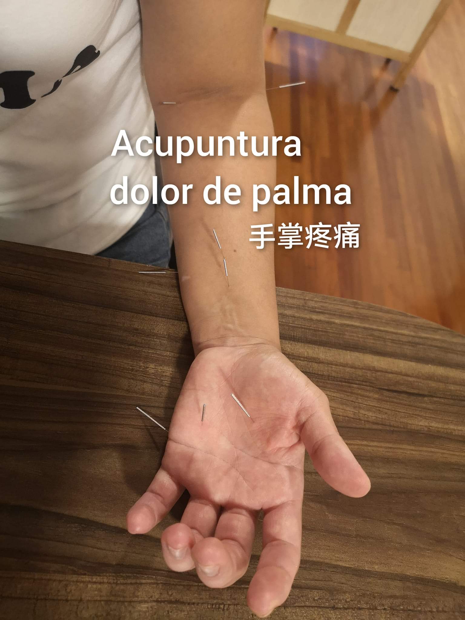 手掌疼痛.jpg