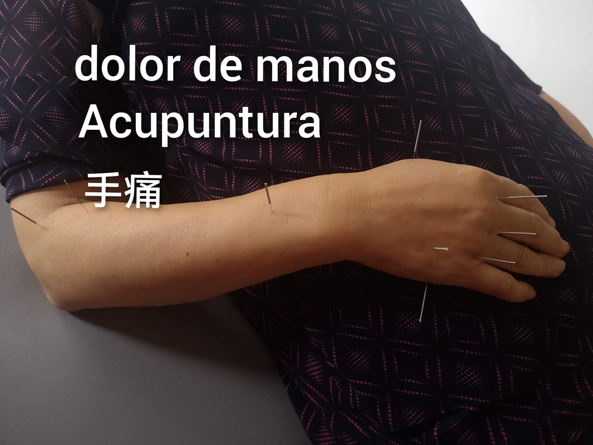 手痛2.jpg