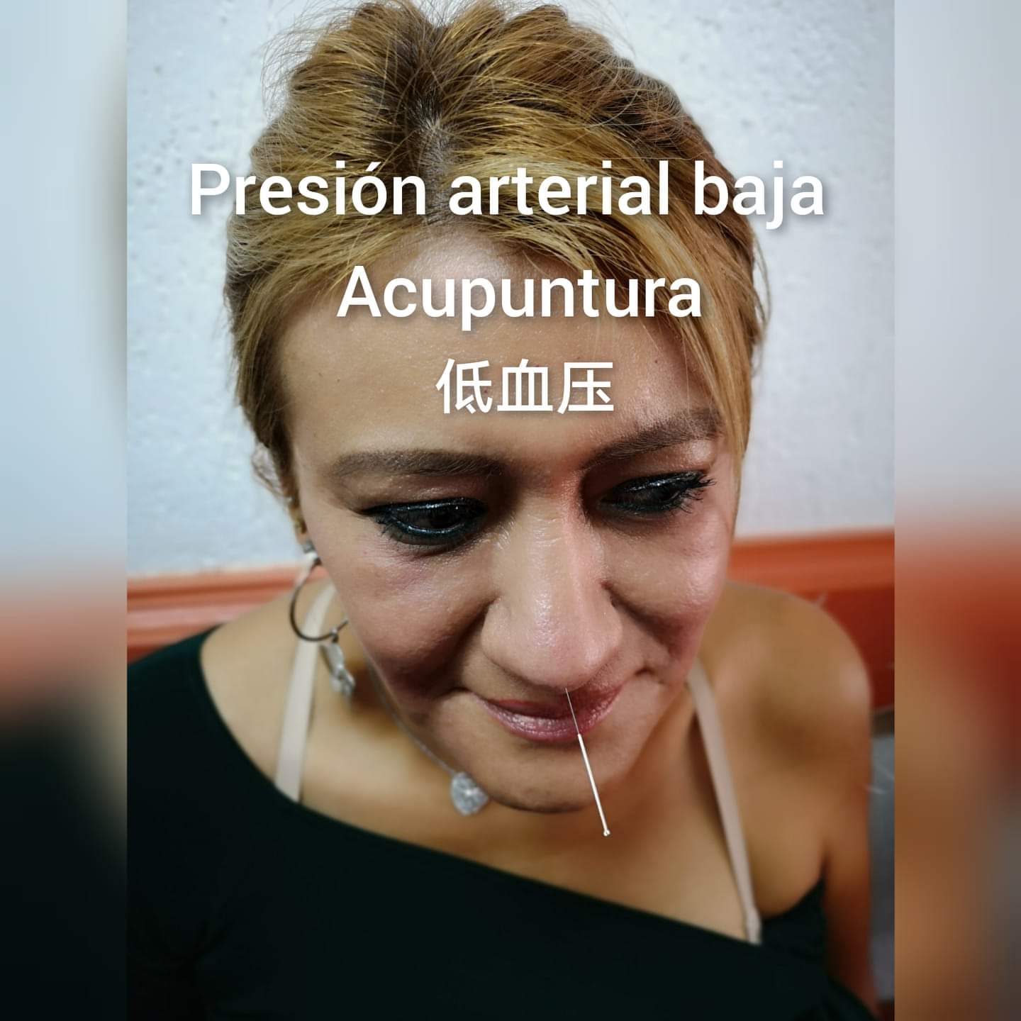 低血压3.jpg
