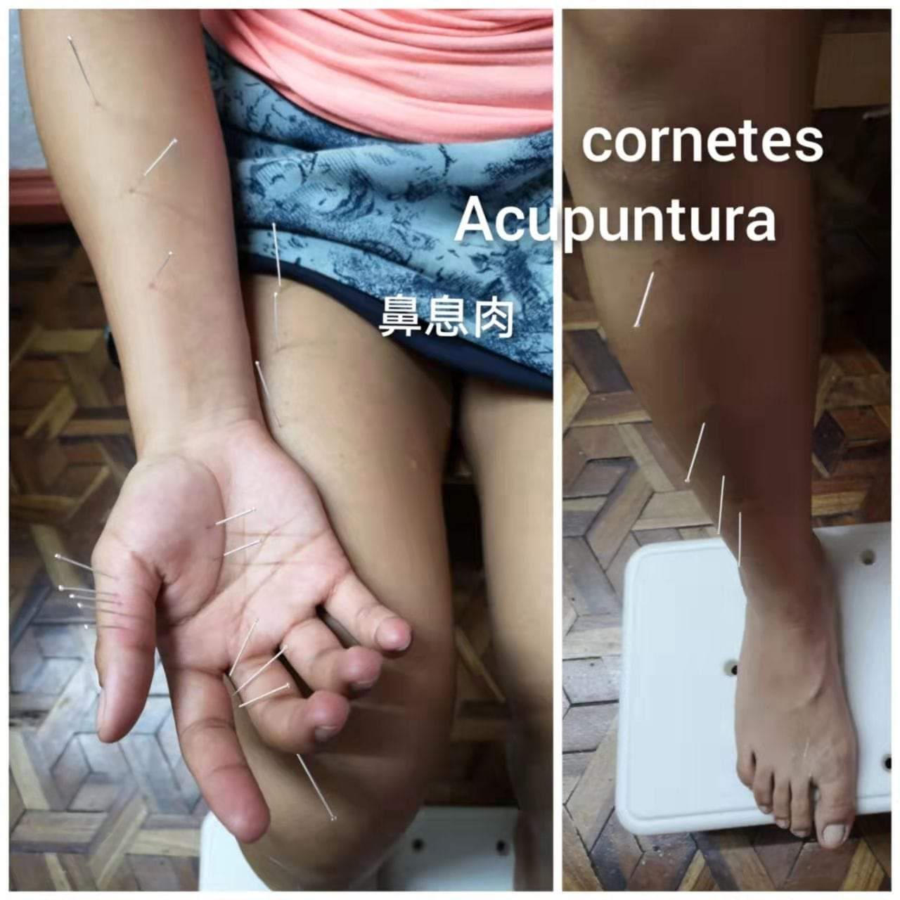 鼻息肉3.jpg