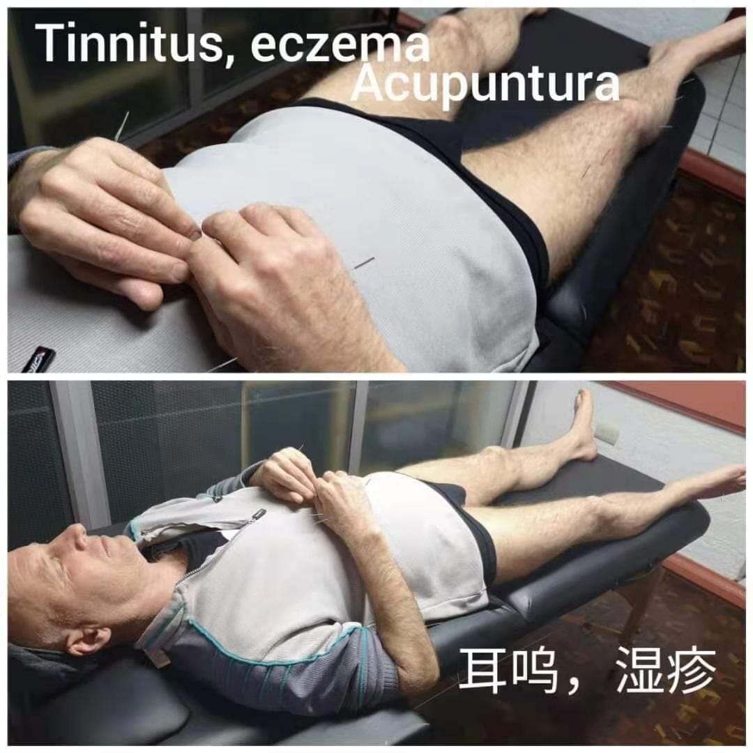 耳呜.jpg