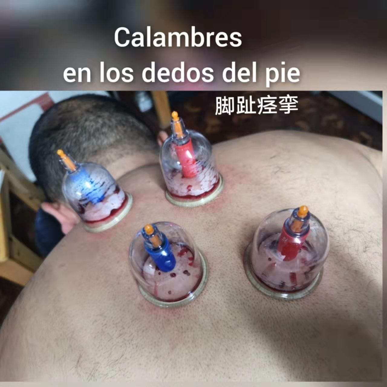 脚趾痉挛.jpg