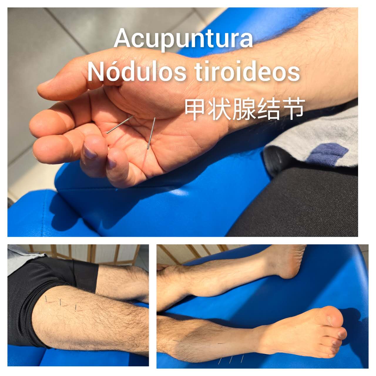 甲状腺结节8.jpg