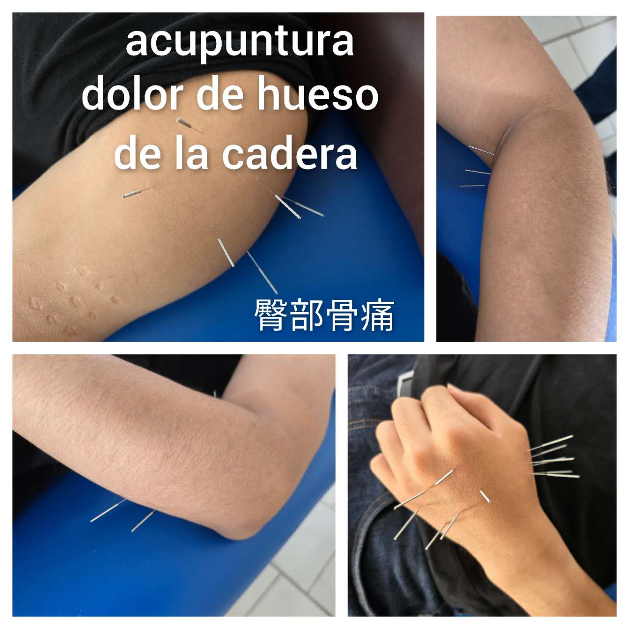 臀部骨痛.jpg