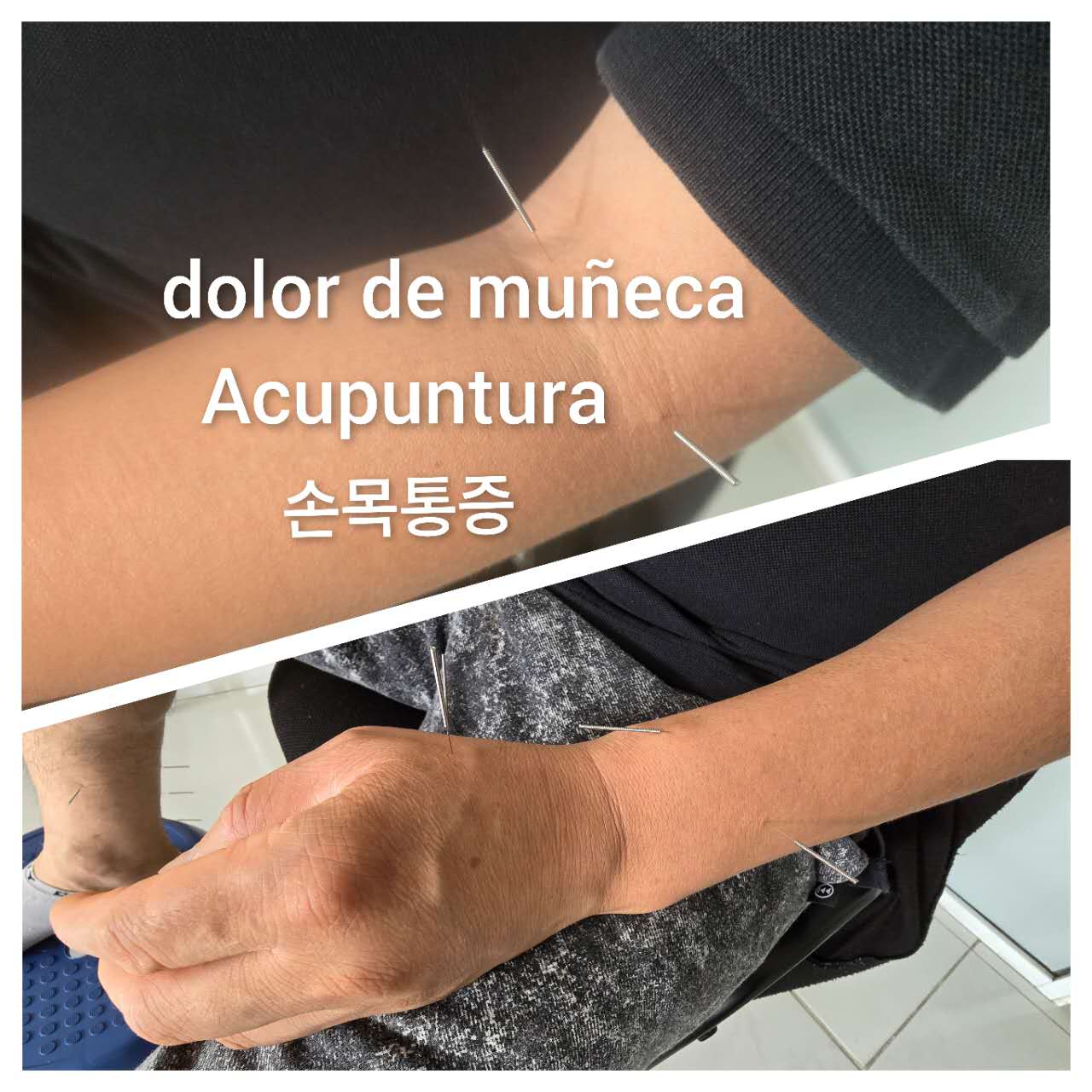 手腕疼痛2.jpg