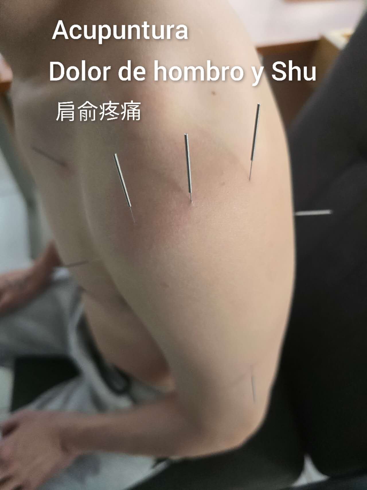 肩髃疼痛.jpg