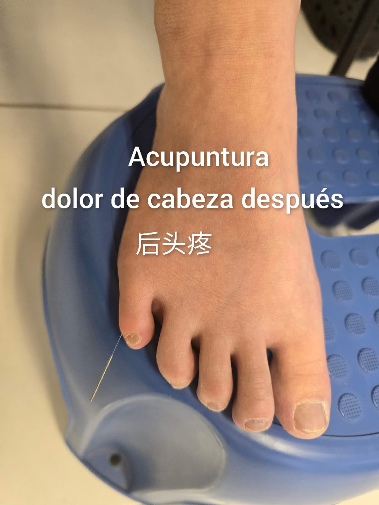 后头疼4.jpg