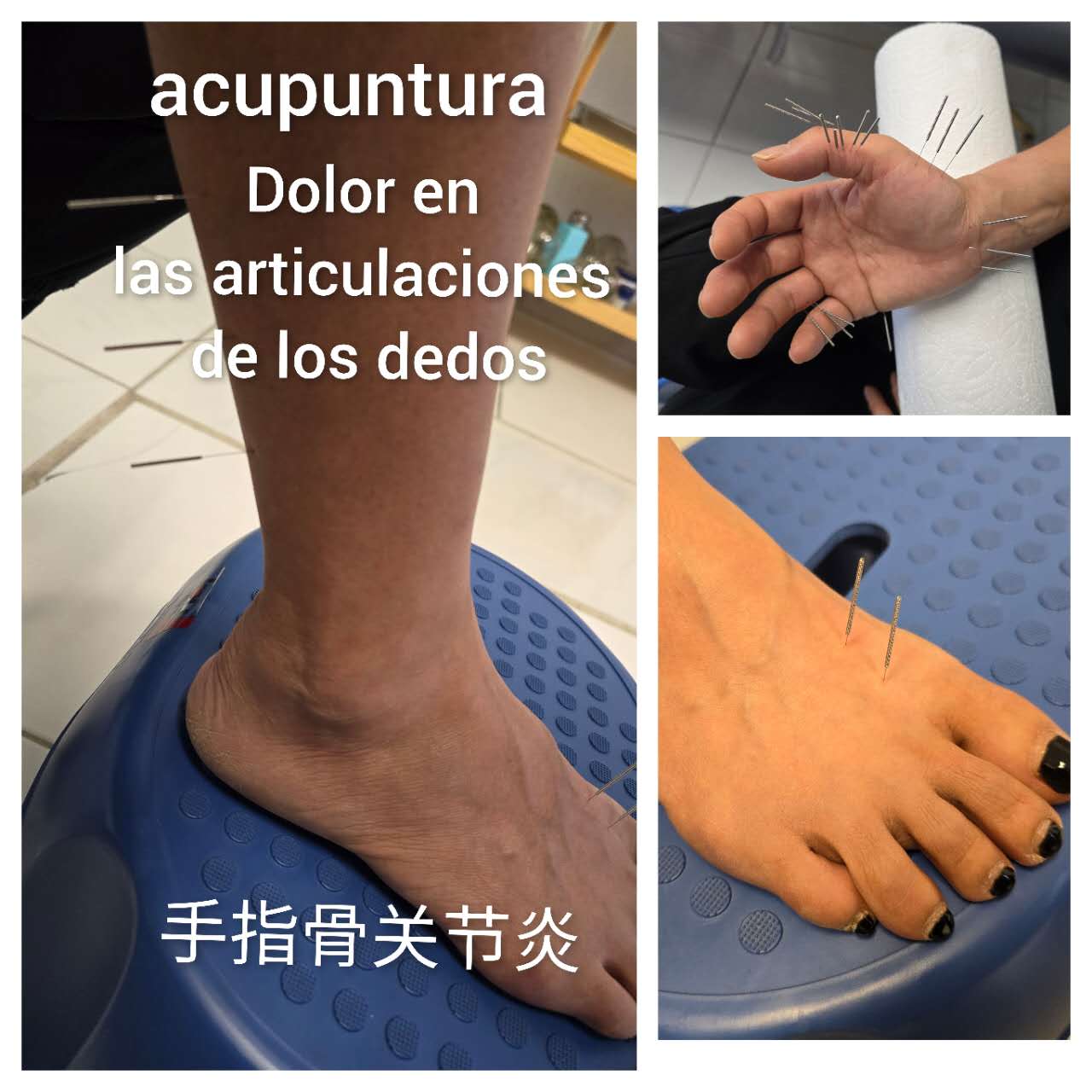 手指骨关节炎.jpg