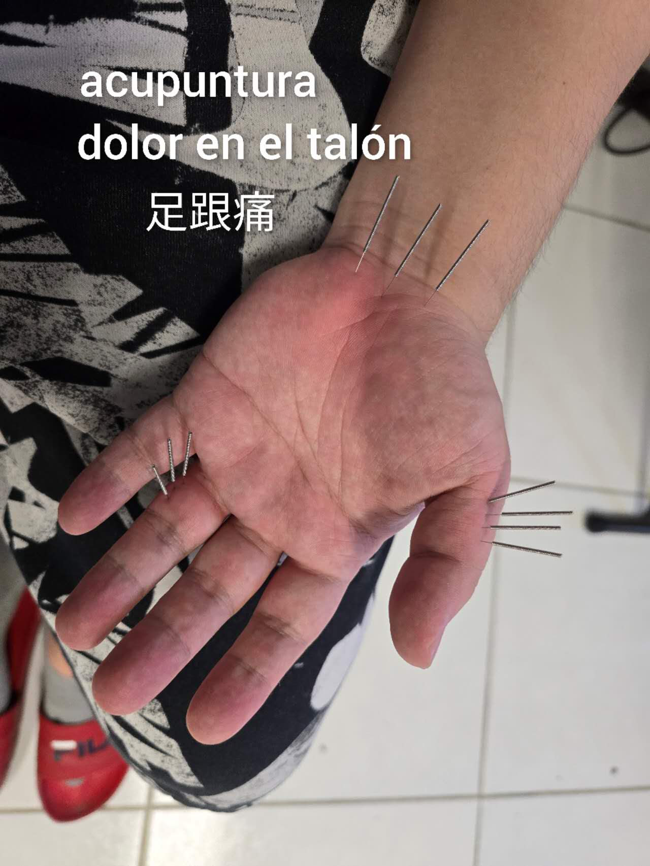 足跟痛8.jpg