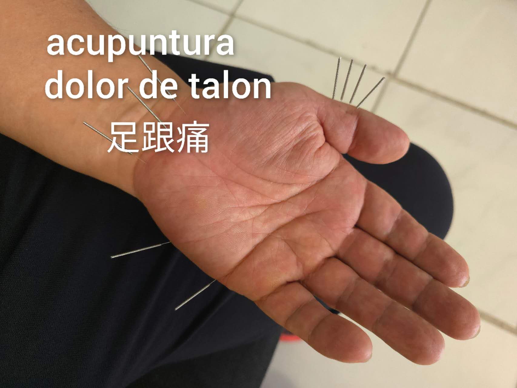 足跟痛5.jpg